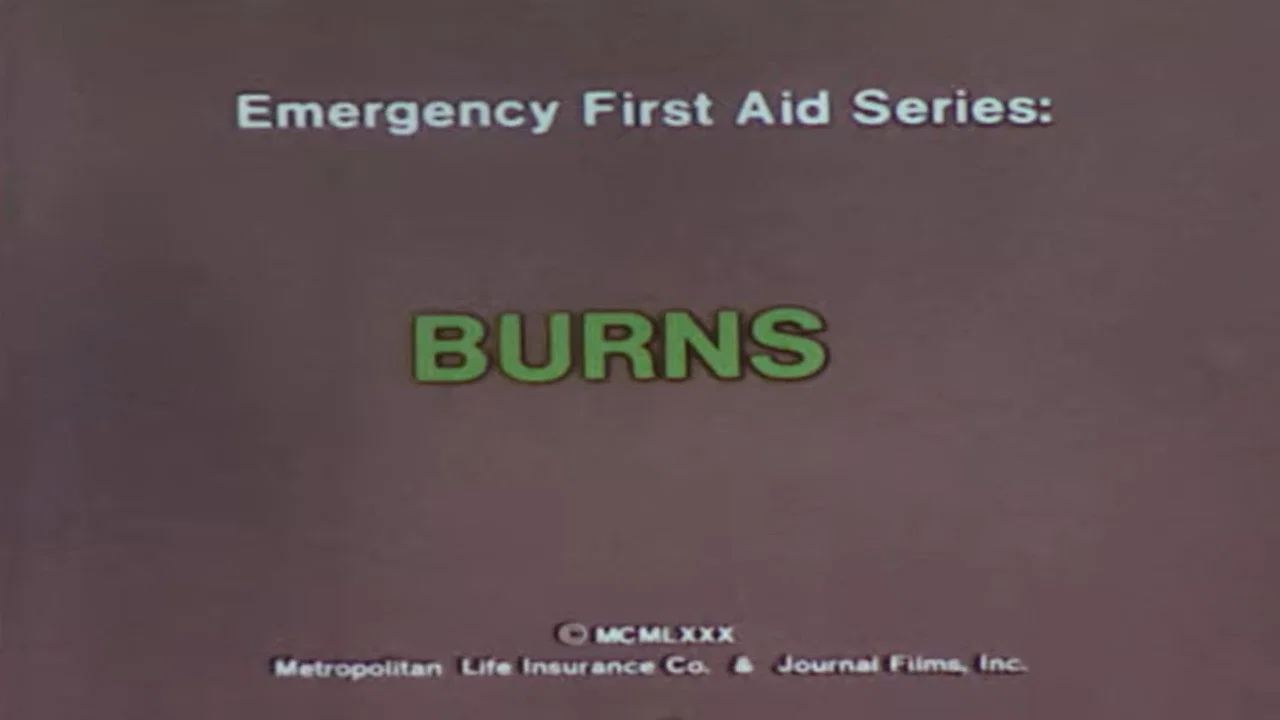 Emergency First Aid Series: Burns - 剧照