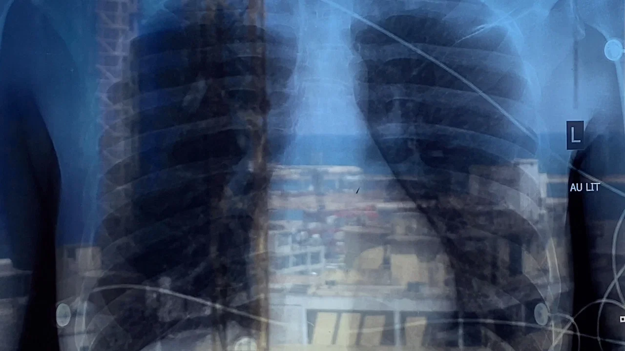 Recovery - 剧照