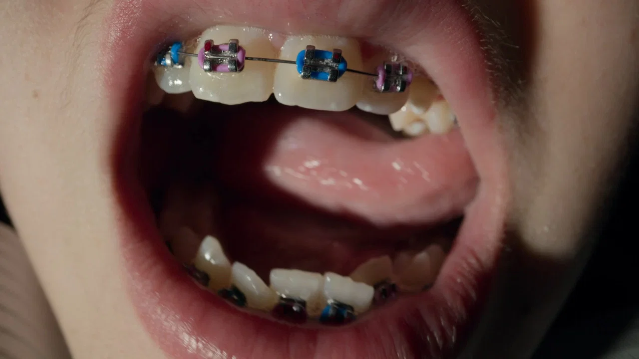 Open Wide - 剧照