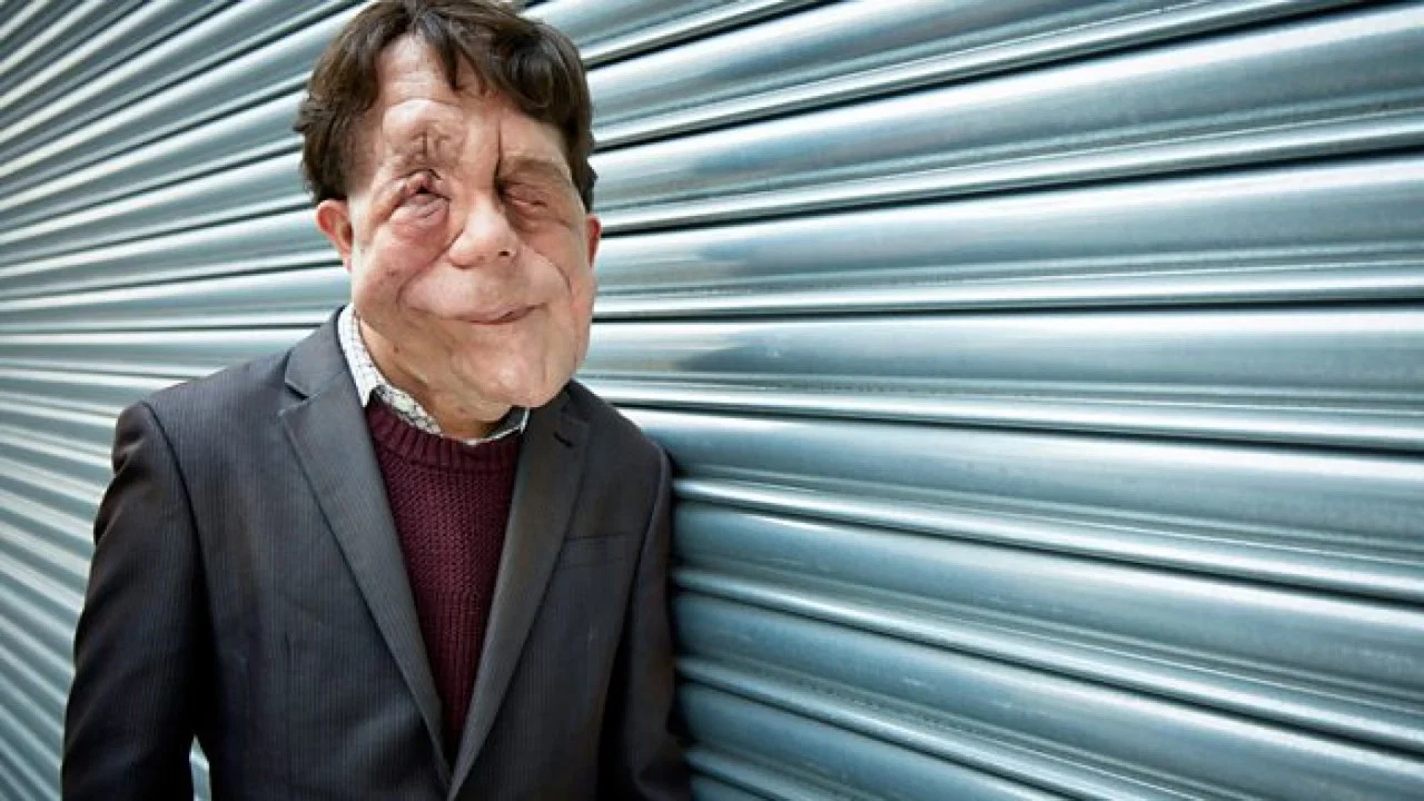 The Ugly Face of Disability Hate Crime - 剧照
