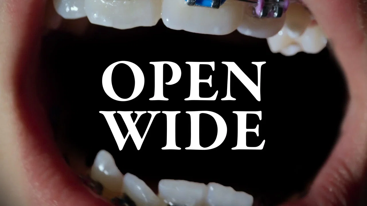Open Wide - 剧照