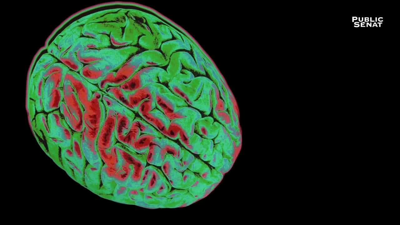 Le pouvoir nuit-il gravement au cerveau ? - 剧照