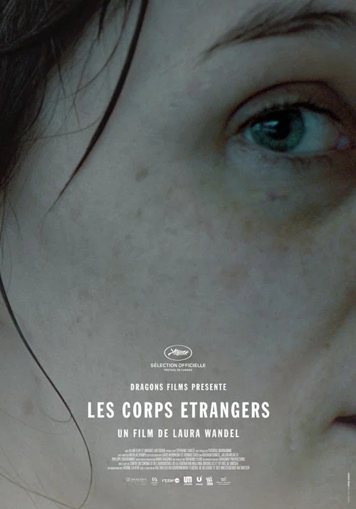 Les corps &eacute;trangers