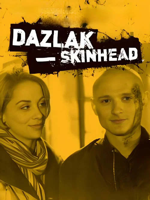 Dazlak &ndash; Skinhead
